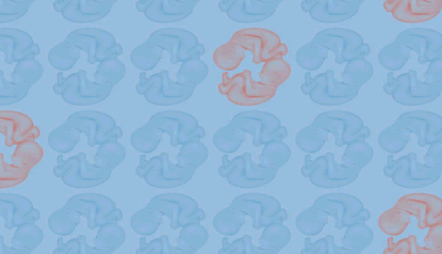 Syndrome du jumeau perdu (Le)