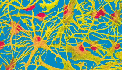 Croyances et thérapie